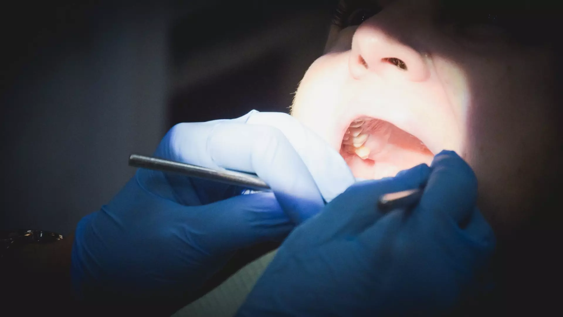 Жительница Казани пошла лечить зубы, но оказалась в реанимации